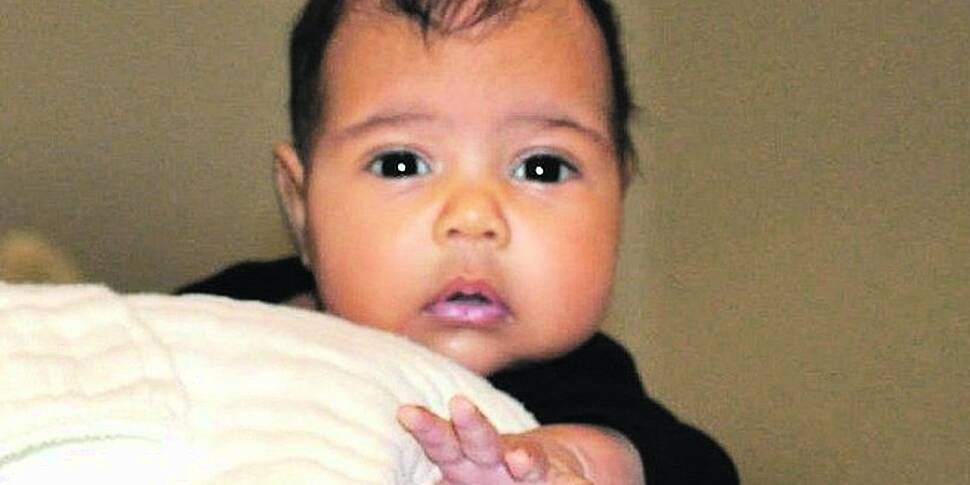 Is Kim Shaping Baby Norths Eye...