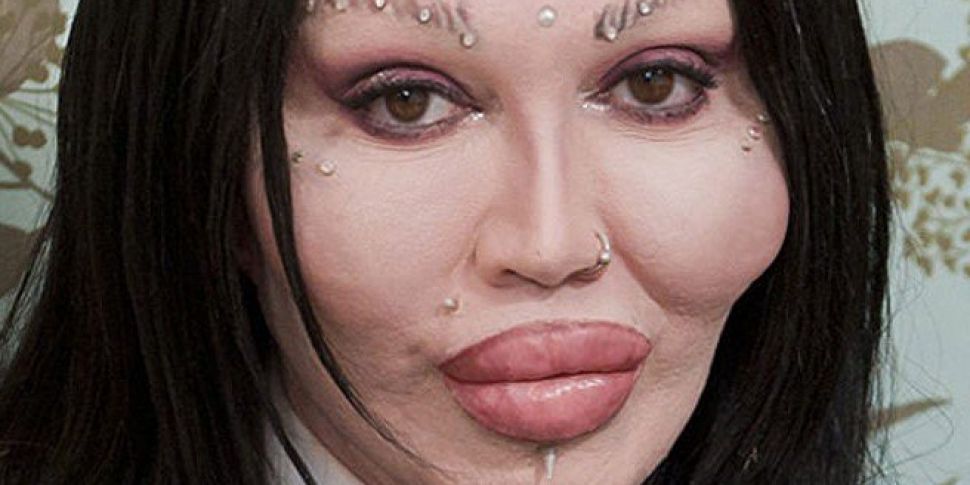 Pete Burns Has Died Aged 57