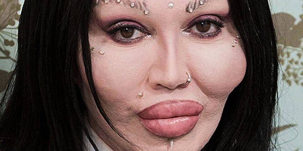 Pete Burns Dead: 'You Spin Me Round' Singer Dies at 57