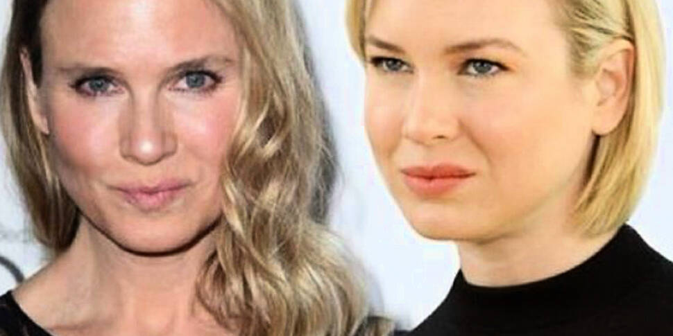 Renee Zellweger speaks out 