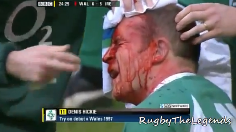 Video Evidence Of Denis Hickie's Bloody Face Against Wales Is Back On Youtube