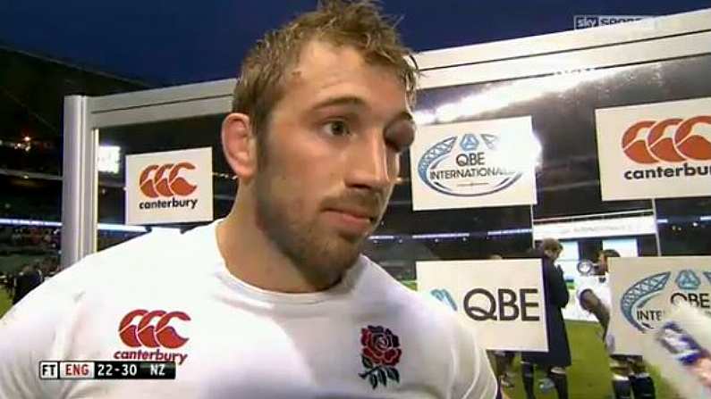 England Captain Chris Robshaw's Eye Is Bolloxed