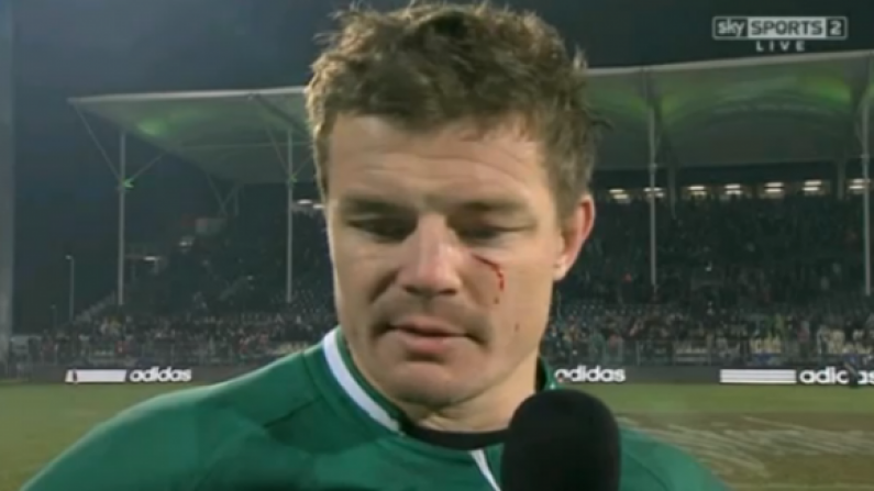Brian O'Driscoll's Cheek Scar Is Crying