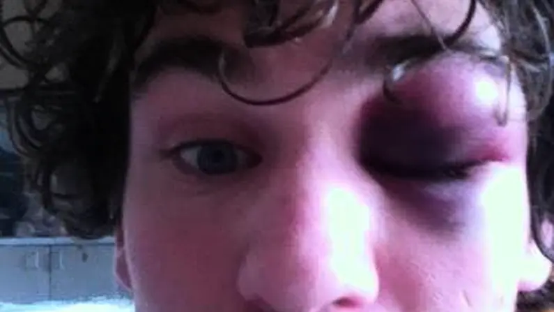 What A Pre-Season Rugby "Friendly" In Kildare Will Do To You.