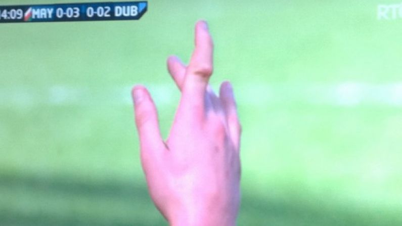 Lee Keegan's Nasty-Looking Dislocated Finger