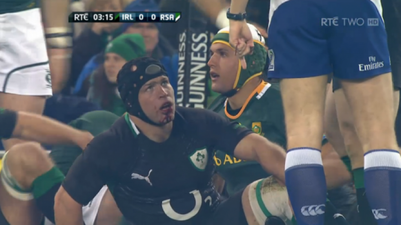 A bloody introduction to international rugby for Richardt Strauss.