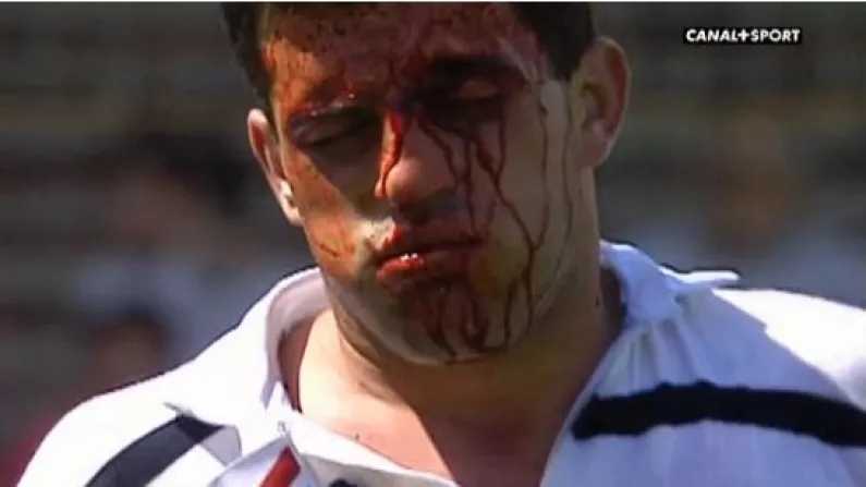 Of Course You Want To Watch The Biggest Fights In French Rugby