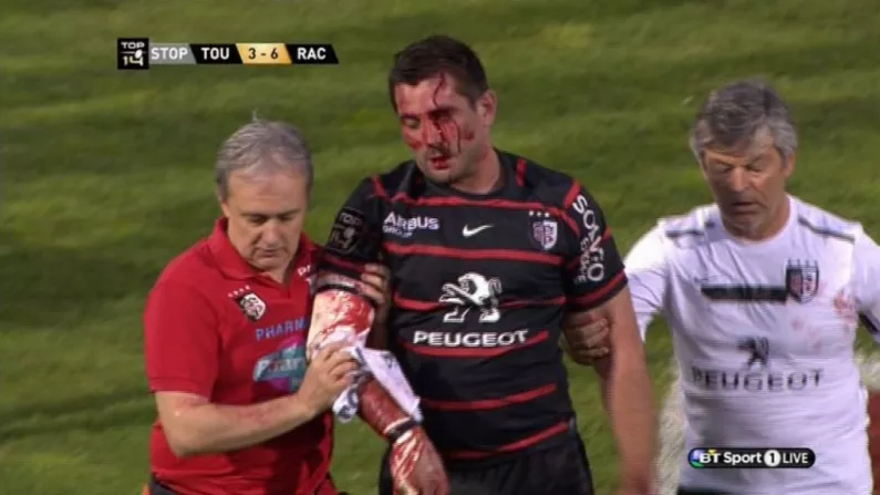 Video: Florian Fritz Allowed Back On Pitch Despite Sustaining Seriously Nasty Blow To The Head