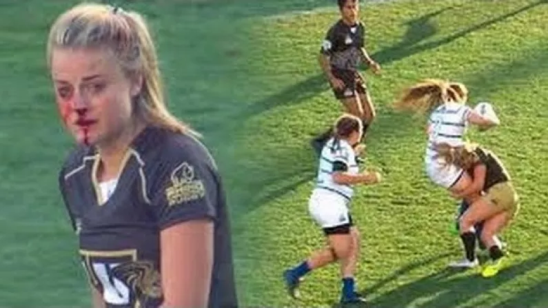 Video: Incredible Commitment From Women's Rugby Player Despite Broken Nose