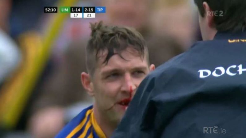The Moment That Seamus Callanan Broke Some Teeth Captured In One Incredible Photo
