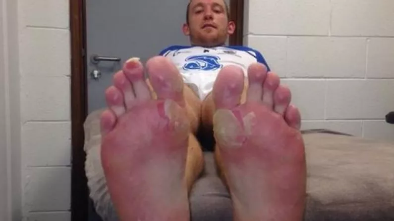 Richie Hogan Explains Cause Of Those Blisters He Suffered During The All-Ireland Semi-Final