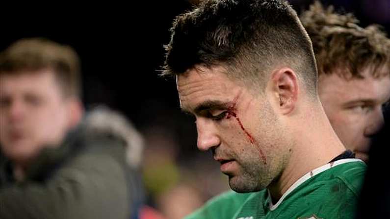 Joe Schmidt's Update On Conor Murray's Gashed Eye Is Reassuring