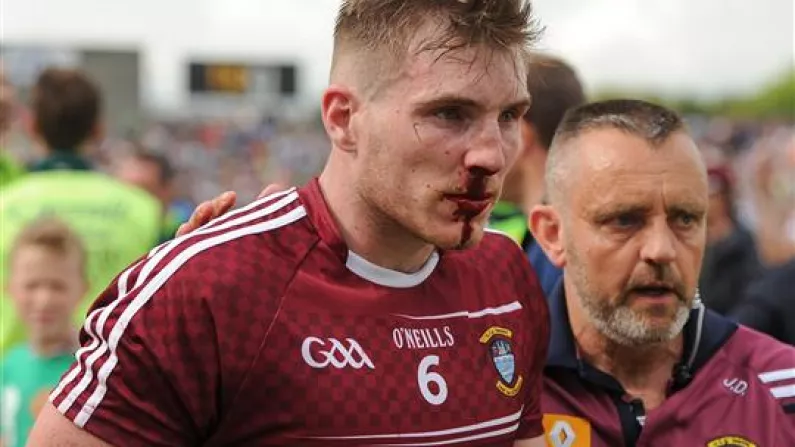 Westmeath's Kieran Martin Left With Possible Broken Nose By 'Altercation' After Offaly Match