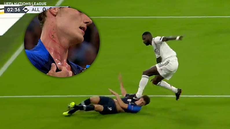 Watch: Antonio Rudiger Gives Benjamin Pavard A Stud Hickey