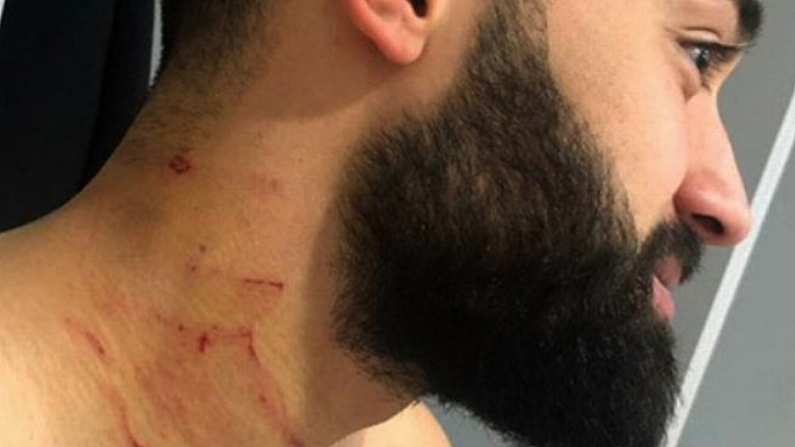 Turkish Footballer Banned For Life After Attacking Opponents With Razor Blade