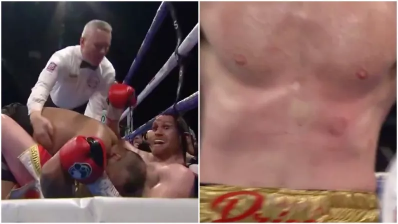 Watch: Kash Ali Disqualified In Fifth Round For Biting Opponent