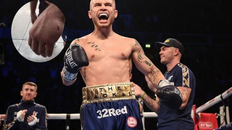 Freak Accident Causes Carl Frampton To Pull Out Of Fight