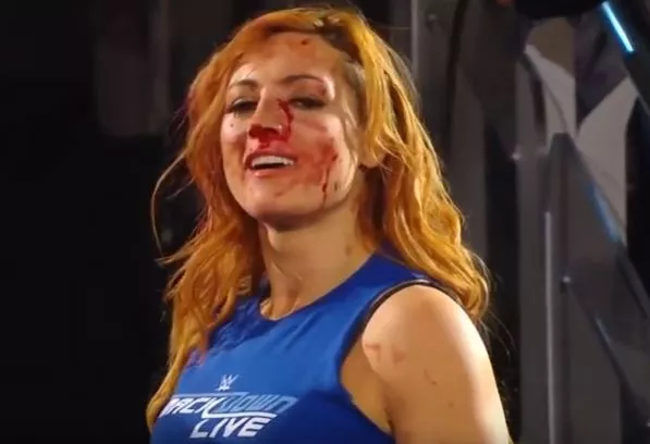 WWE-Becky-Lynch