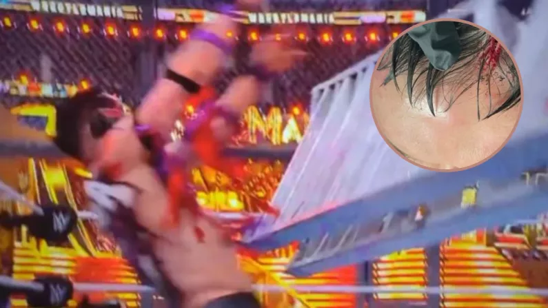 Wrestlemania: Finn Balor Reveals Gruesome Injury Caused By Flying Ladder