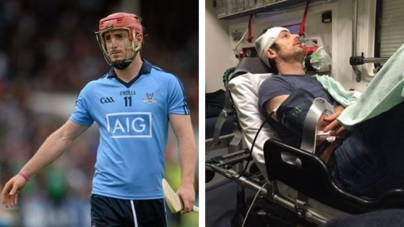'I Didn't Even See The Punch Coming. I Fractured My Skull, Broke My Jaw'