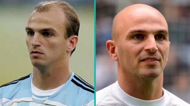 Best Bald Footballers