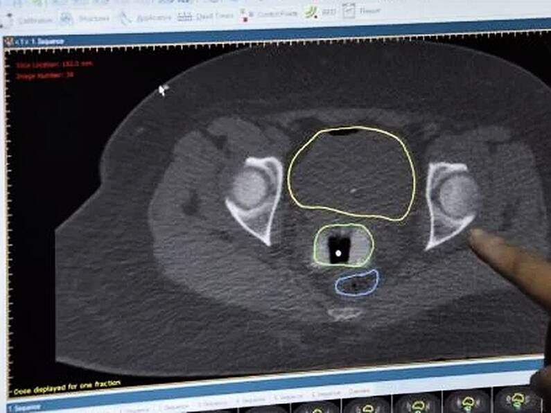 Over 380 claims brought against CervicalCheck programme