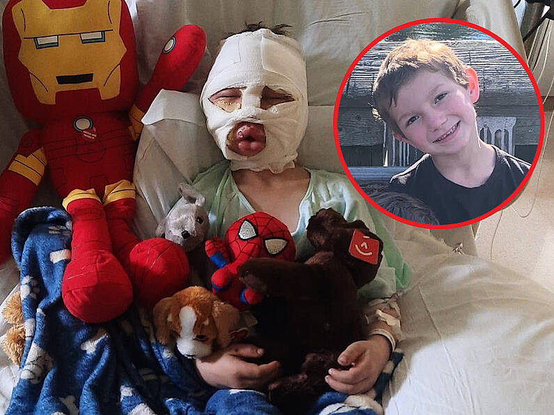 6-year-old boy left with devastating burns after being 'set on fire' by bully