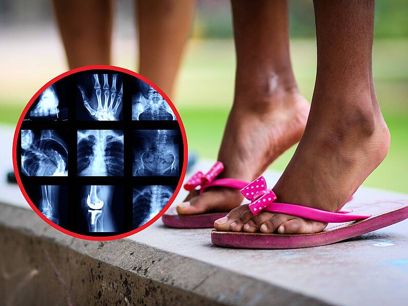 Flip-flops crowned most dangerous summer wear