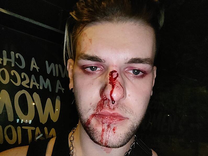 Young man assaulted in suspected homophobic attack on Dublin bus