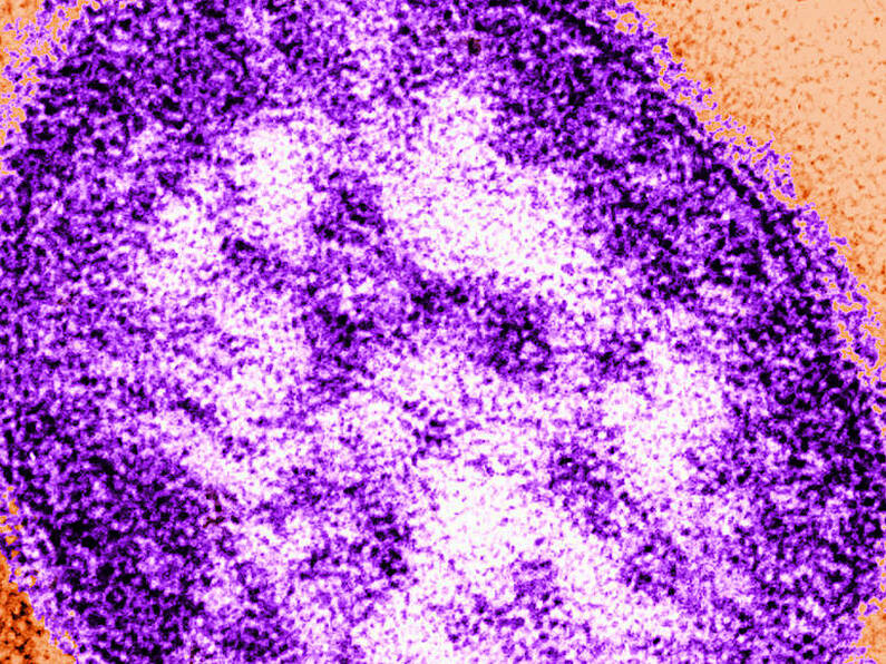 Nine suspected cases of measles in Ireland recorded in one week