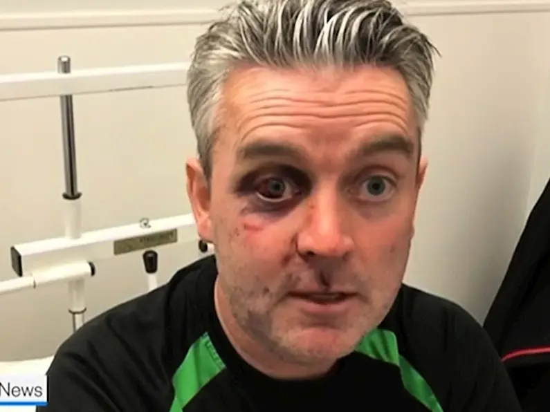 Four men released as part of investigation into attack on referee