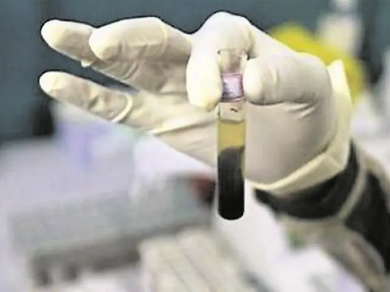 Govt allocates an extra €450k for HIV treatment schemes in four cities