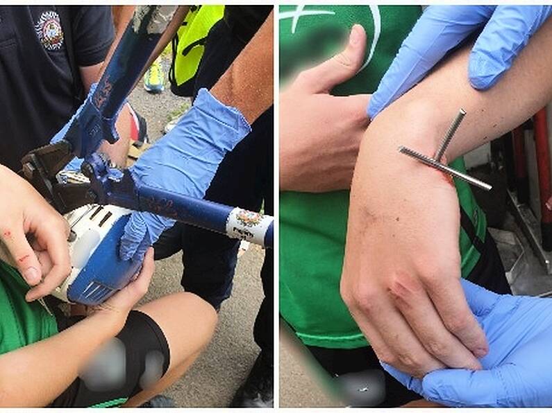 Young hurler injured after helmet wire punctures his hand