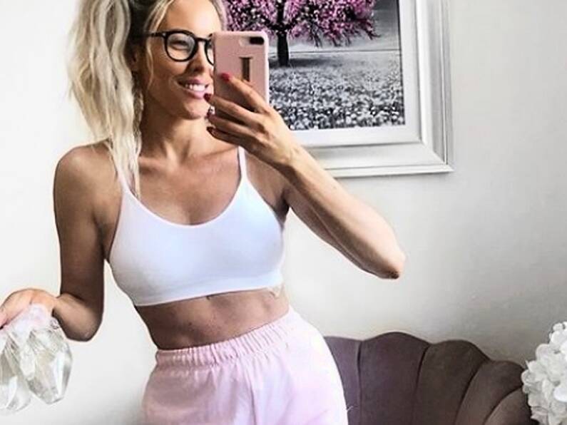 Cork blogger Lisa Jordan opens up about having her breast implants removed