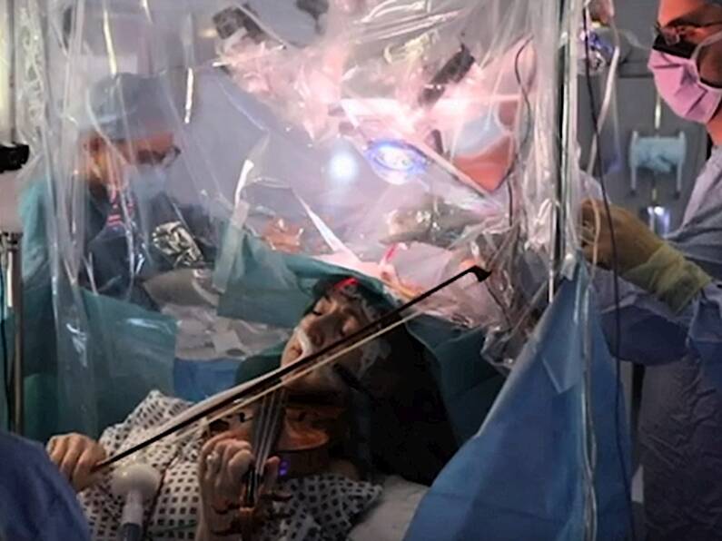 Patient plays violin during her own brain operation