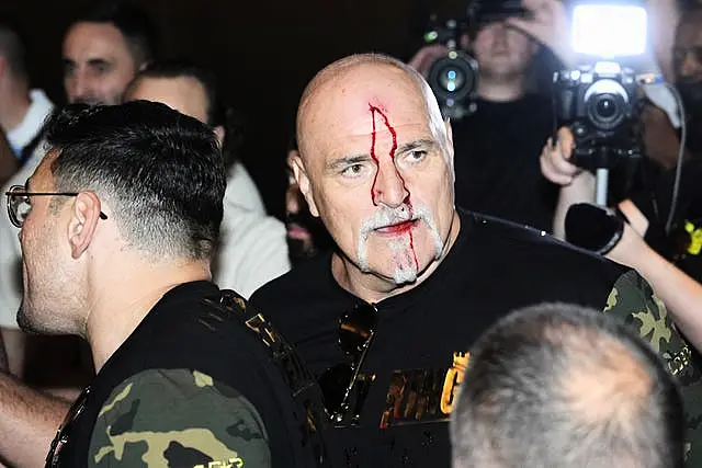 Tyson Fury's father John Fury with blood on his face after a pre-fight altercation with Oleksandr Usyk's camp