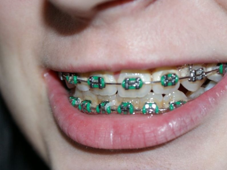 More than 1,000 children wait over four years for orthodontic treatment, claim FF