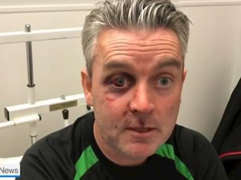 Four men released as part of investigation into attack on referee