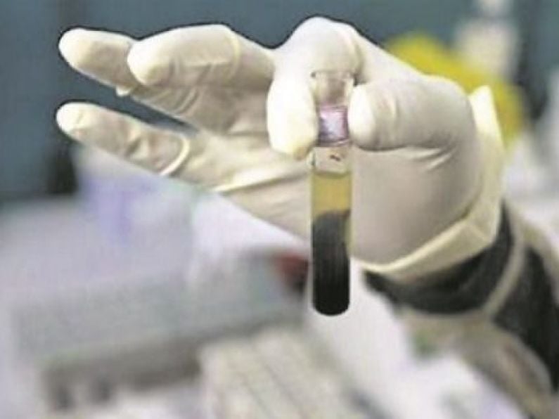 Govt allocates an extra €450k for HIV treatment schemes in four cities