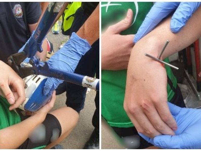 Young hurler injured after helmet wire punctures his hand