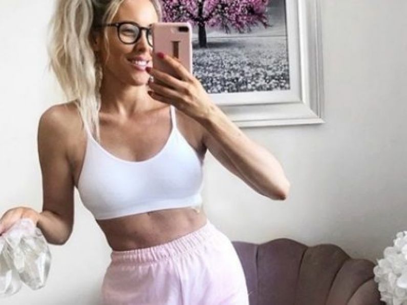 Cork blogger Lisa Jordan opens up about having her breast implants removed