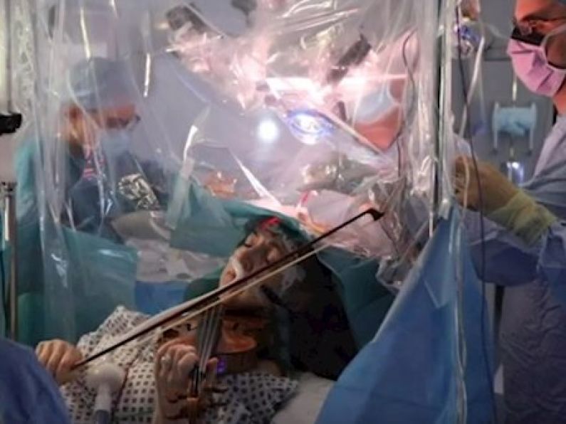 Patient plays violin during her own brain operation