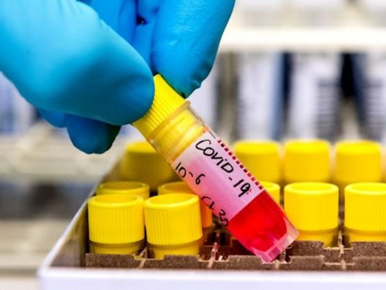 BREAKING: 480 new cases of coronavirus in Ireland