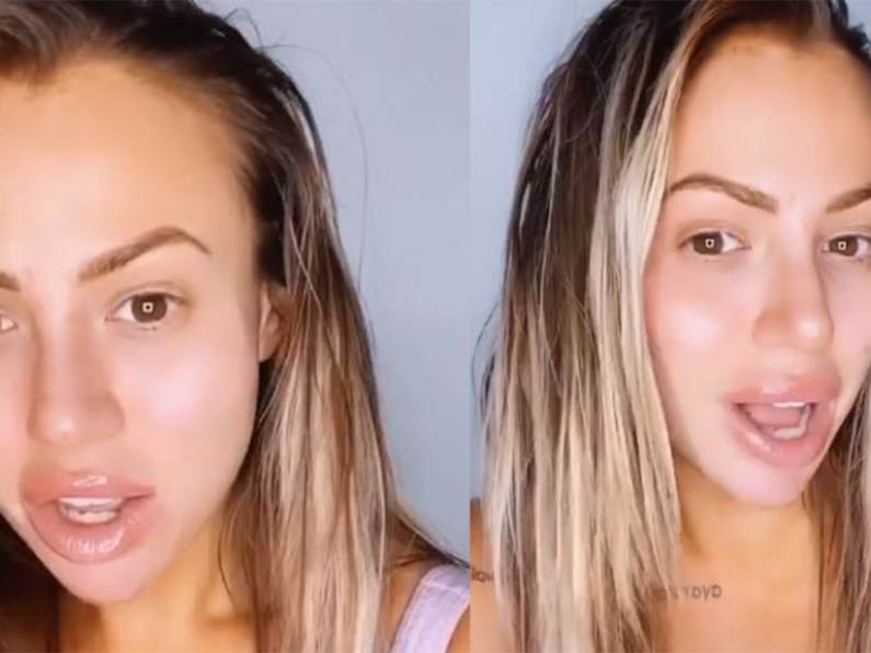 Ex Geordie Shore Star Holly says surgery left her looking "worse"