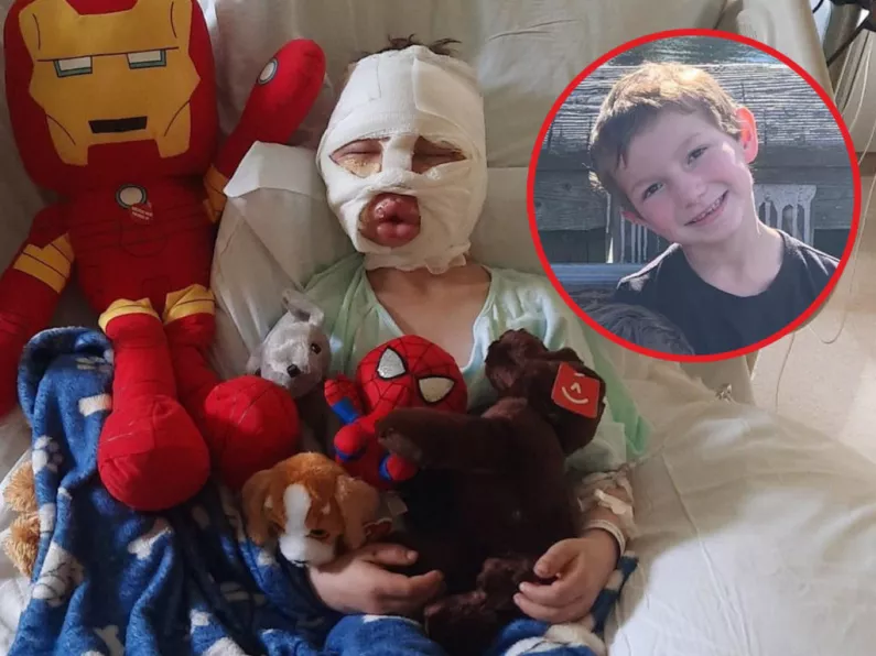 6-year-old boy left with devastating burns after being 'set on fire' by bully