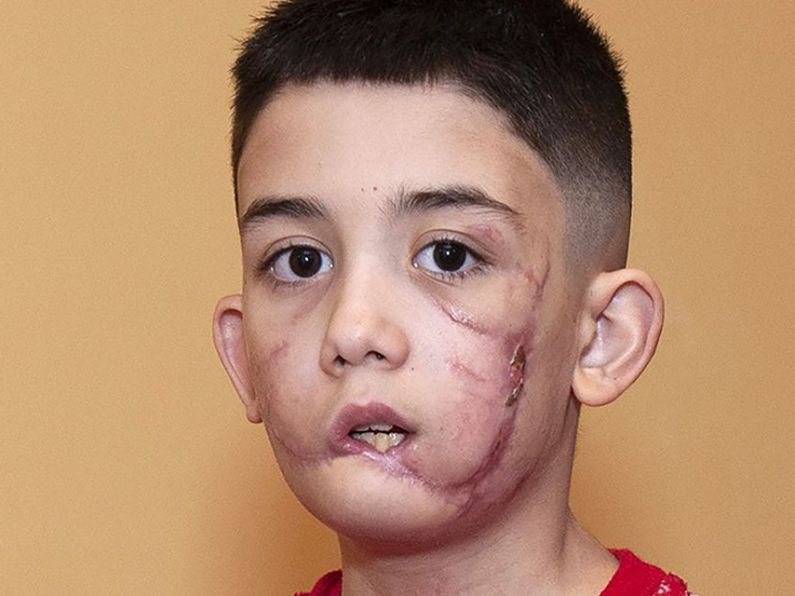 Couple jailed in relation to XL Bully attack on Wexford boy Alejandro Mizsan