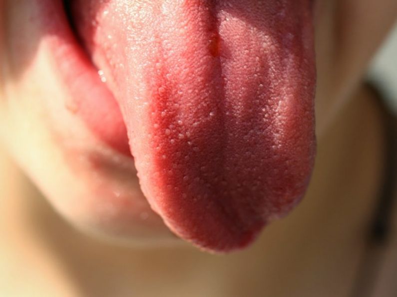 Sexual assault victim bites off attacker's tongue