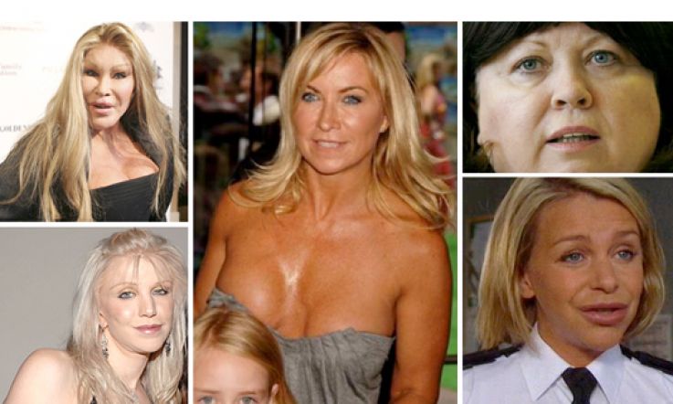 Stars Who Really SHOULD Roar at Their Plastic Surgeon