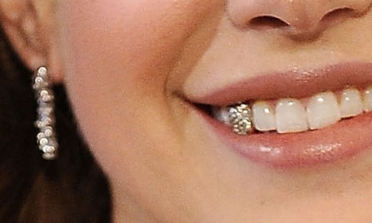 A '90s revival too far: Tooth gems are back