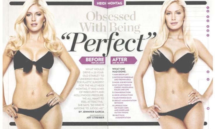 Heidi Montag and the plastic surgery: you were grand anyway